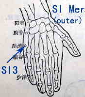 acupuncture acupressure small intestine meridian points SI3