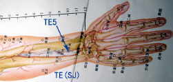 Triple Energizer Sanjiao Acupuncture Meridian points TE5