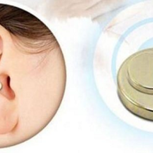 Anti-Smoke Zerosmoke Auricular Therapy Magnets